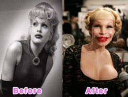 celebrity_plastic_surgery_640_03.jpg